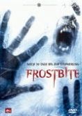 Frostbite